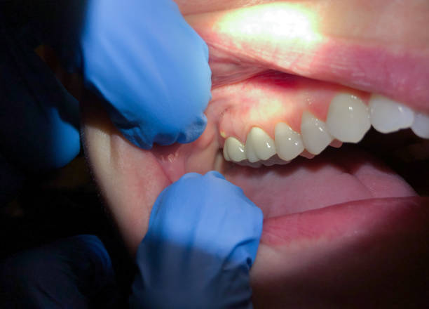 Best Emergency Dental Services for Seniors in Mcleansville, NC